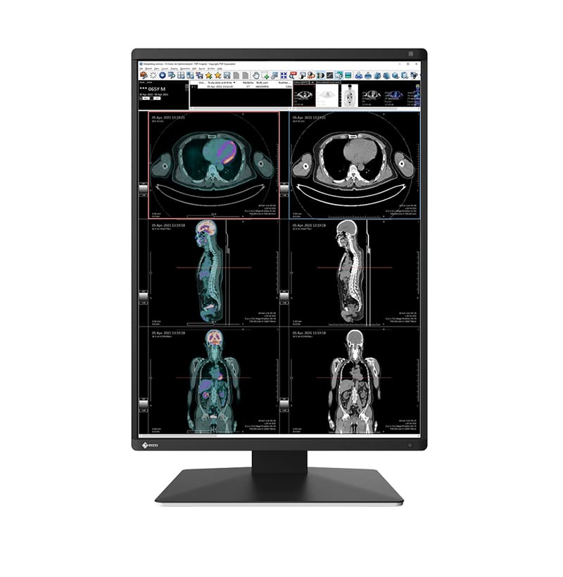 EIZO RadiForce RX370 computer monitor 54.1 cm (21.3") 1536 x 2048 pixels LCD Black