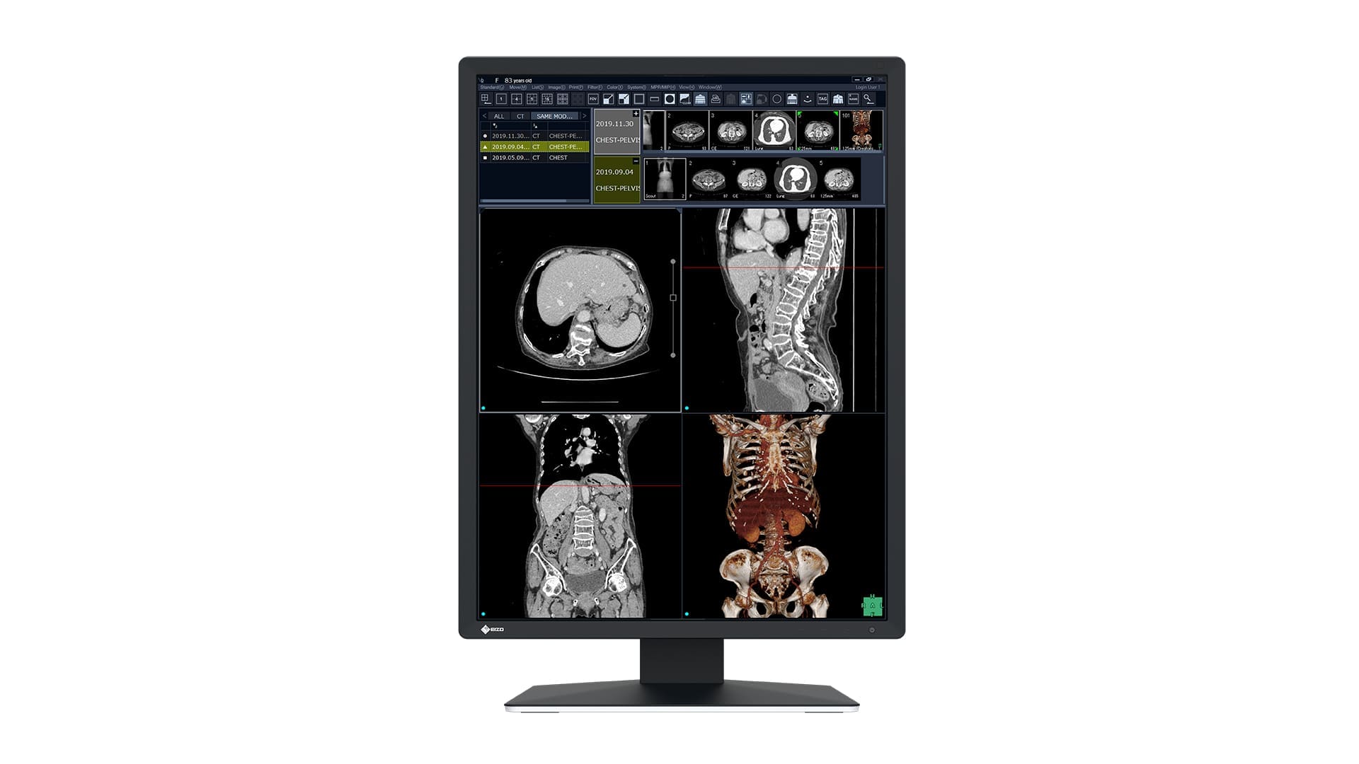 EIZO RadiForce RX270 computer monitor 54.1 cm (21.3") 1200 x 1600 pixels UXGA LCD Black, White